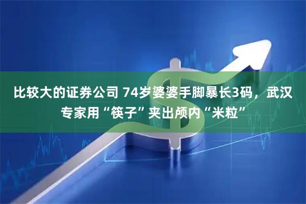 比较大的证券公司 74岁婆婆手脚暴长3码，武汉专家用“筷子”夹出颅内“米粒”